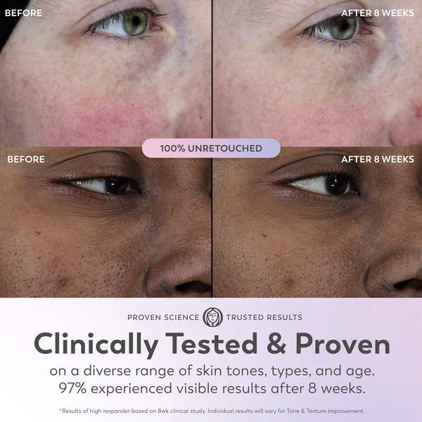 Tinh Chất Dưỡng Da Olay Super Serum – Chai 1 Oz